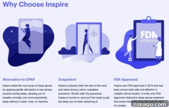 Inspire: A Better Way to Treat Sleep Apnea 7 inspire sleep apnea therapy